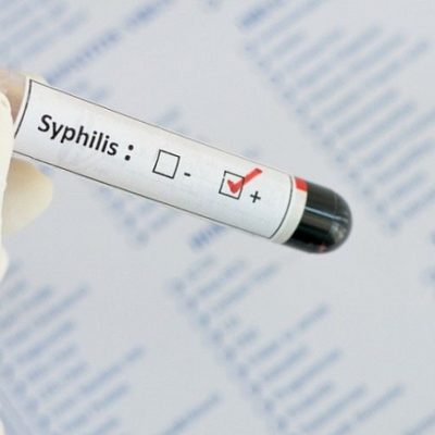 Может ли после лечения гепатита с определяться гепатит в обычном анализе thumbnail